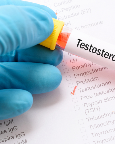 Blue gloved physician hand holding a vial of blood with a yellow cap over a lab result report that indicates a testosterone panel